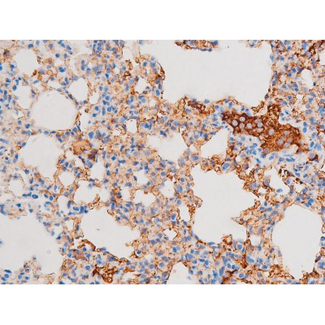 DNM1 / Dynamin Antibody - 1:200 staining mouse lung tissue by IHC-P. The tissue was formaldehyde fixed and a heat mediated antigen retrieval step in citrate buffer was performed. The tissue was then blocked and incubated with the antibody for 1.5 hours at 22°C. An HRP conjugated goat anti-rabbit antibody was used as the secondary.
