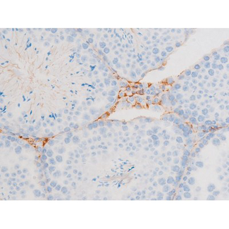 DNM1 / Dynamin Antibody - 1:200 staining mouse testis tissue by IHC-P. The tissue was formaldehyde fixed and a heat mediated antigen retrieval step in citrate buffer was performed. The tissue was then blocked and incubated with the antibody for 1.5 hours at 22°C. An HRP conjugated goat anti-rabbit antibody was used as the secondary.
