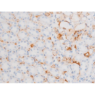 DNM1 / Dynamin Antibody - 1:200 staining rat kidney tissue by IHC-P. The tissue was formaldehyde fixed and a heat mediated antigen retrieval step in citrate buffer was performed. The tissue was then blocked and incubated with the antibody for 1.5 hours at 22°C. An HRP conjugated goat anti-rabbit antibody was used as the secondary.