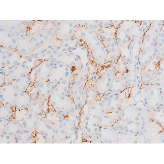 DNM1 / Dynamin Antibody - 1:200 staining rat kidney tissue by IHC-P. The tissue was formaldehyde fixed and a heat mediated antigen retrieval step in citrate buffer was performed. The tissue was then blocked and incubated with the antibody for 1.5 hours at 22°C. An HRP conjugated goat anti-rabbit antibody was used as the secondary.