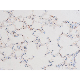 DNM1 / Dynamin Antibody - 1:200 staining rat lung tissue by IHC-P. The tissue was formaldehyde fixed and a heat mediated antigen retrieval step in citrate buffer was performed. The tissue was then blocked and incubated with the antibody for 1.5 hours at 22°C. An HRP conjugated goat anti-rabbit antibody was used as the secondary.