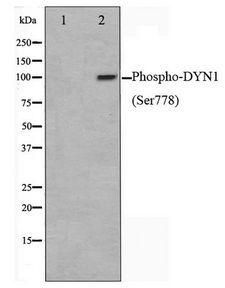 DNM1 / Dynamin Antibody - Western blot of mouse brain cell lysate using Phospho-DYN1(Ser778) Antibody