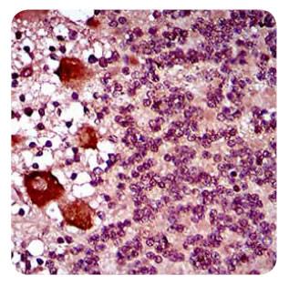 DNM1L / DRP1 Antibody - Immunohistochemistry: DRP1 Antibody (4E11B11) - IHC analysis of paraffin-embedded human cerebellum tissues using DRP1 mouse mAb with DAB staining.  This image was taken for the unconjugated form of this product. Other forms have not been tested.