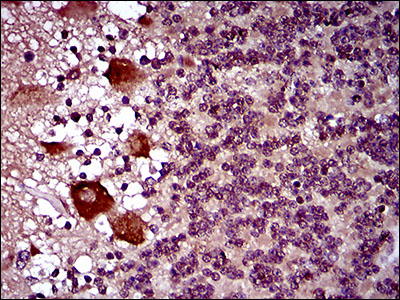 DNM1L / DRP1 Antibody - IHC of paraffin-embedded cerebellum tissues using DNM1L mouse monoclonal antibody with DAB staining.