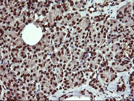 DNM1L / DRP1 Antibody - IHC of paraffin-embedded Human pancreas tissue using anti-DNM1L mouse monoclonal antibody.