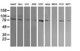 DNM1L / DRP1 Antibody - Western blot of extracts (35 ug) from 9 different cell lines by using anti-DNM1L monoclonal antibody (HepG2: human; HeLa: human; SVT2: mouse; A549: human; COS7: monkey; Jurkat: human; MDCK: canine; PC12: rat; MCF7: human).