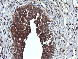 DNM1L / DRP1 Antibody - IHC of paraffin-embedded Human bladder tissue using anti-DNM1L mouse monoclonal antibody.