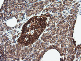 DNM1L / DRP1 Antibody - IHC of paraffin-embedded Human pancreas tissue using anti-DNM1L mouse monoclonal antibody.