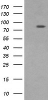 DNM1L / DRP1 Antibody - HEK293T cells were transfected with the pCMV6-ENTRY control (Left lane) or pCMV6-ENTRY DNM1L (Right lane) cDNA for 48 hrs and lysed. Equivalent amounts of cell lysates (5 ug per lane) were separated by SDS-PAGE and immunoblotted with anti-DNM1L.