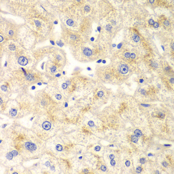 DNM1L / DRP1 Antibody - Immunohistochemistry of paraffin-embedded human liver injury tissue.