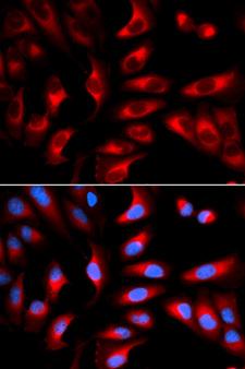 DNM1L / DRP1 Antibody - Immunofluorescence analysis of U2OS cells.
