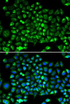 DNM1L / DRP1 Antibody - Immunofluorescence analysis of HeLa cells.