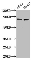 DNM1L / DRP1 Antibody - Western Blot Positive WB detected in: A549 whole cell lysate, Mouse heart tissue All lanes: DNM1L antibody at 0.5µg/ml Secondary Goat polyclonal to rabbit IgG at 1/50000 dilution Predicted band size: 82, 81, 80, 78, 84, 61, 83 kDa Observed band size: 82 kDa