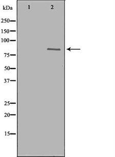 DNM1L / DRP1 Antibody - Western blot analysis of K562 whole cells lysates using DRP1 antibody. The lane on the left is treated with the antigen-specific peptide.