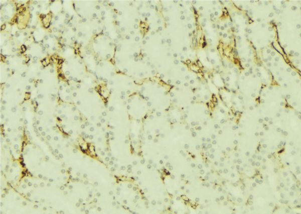 DNM1L / DRP1 Antibody - 1:100 staining mouse kidney tissue by IHC-P. The sample was formaldehyde fixed and a heat mediated antigen retrieval step in citrate buffer was performed. The sample was then blocked and incubated with the antibody for 1.5 hours at 22°C. An HRP conjugated goat anti-rabbit antibody was used as the secondary.