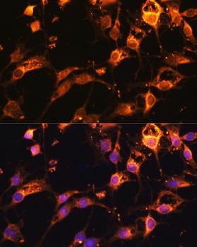 DNM1L / DRP1 Antibody - Immunofluorescence analysis of C6 cells using DRP1 Polyclonal Antibody at dilution of 1:100.Blue: DAPI for nuclear staining.