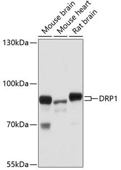 DNM1L / DRP1 Antibody - Western blot analysis of extracts of various cell lines using DRP1 Polyclonal Antibody at dilution of 1:1000.