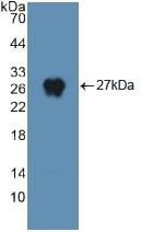 DNM2 / Dynamin-2 Antibody - Western Blot; Sample: Recombinant DNM2, Human.