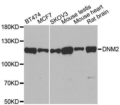 DNM2 / Dynamin-2 Antibody - Western blot analysis of extracts of various cell lines, using DNM2 antibody at 1:500 dilution. The secondary antibody used was an HRP Goat Anti-Rabbit IgG (H+L) at 1:10000 dilution. Lysates were loaded 25ug per lane and 3% nonfat dry milk in TBST was used for blocking. An ECL Kit was used for detection and the exposure time was 90s.
