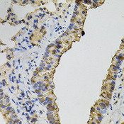DNM2 / Dynamin-2 Antibody - Immunohistochemistry of paraffin-embedded mouse lung using DNM2 antibody(40x lens).