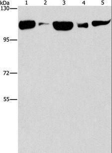 DNM2 / Dynamin-2 Antibody - Western blot analysis of Raji cell and human fetal liver tissue, NIH/3T3 cell and mouse brain tissue, HeLa cell, using DNM2 Polyclonal Antibody at dilution of 1:400.