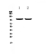 DNM2 / Dynamin-2 Antibody - Western blot - Anti-Dynamin 2 Picoband antibody