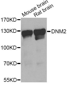 DNM2 / Dynamin-2 Antibody - Western blot analysis of extracts of various cell lines, using DNM2 Antibody at 1:1000 dilution. The secondary antibody used was an HRP Goat Anti-Rabbit IgG (H+L) at 1:10000 dilution. Lysates were loaded 25ug per lane and 3% nonfat dry milk in TBST was used for blocking. An ECL Kit was used for detection and the exposure time was 15s.