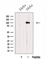 DNM2 / Dynamin-2 Antibody - Western blot analysis of extracts of HeLa cells using DNM2 antibody. The lane on the left was treated with blocking peptide.