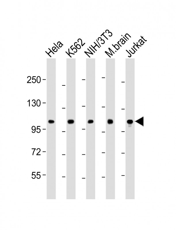 DNM2 / Dynamin-2 Antibody - All lanes: Anti-DNM2 Antibody (N-Term) at 1:2000 dilution Lane 1: Hela whole cell lysate Lane 2: K562 whole cell lysate Lane 3: NIH/3T3 whole cell lysate Lane 4: mouse brain lysate Lane 5: Jurkat whole cell lysate Lysates/proteins at 20 µg per lane. Secondary Goat Anti-Rabbit IgG, (H+L), Peroxidase conjugated at 1/10000 dilution. Predicted band size: 98 kDa Blocking/Dilution buffer: 5% NFDM/TBST.