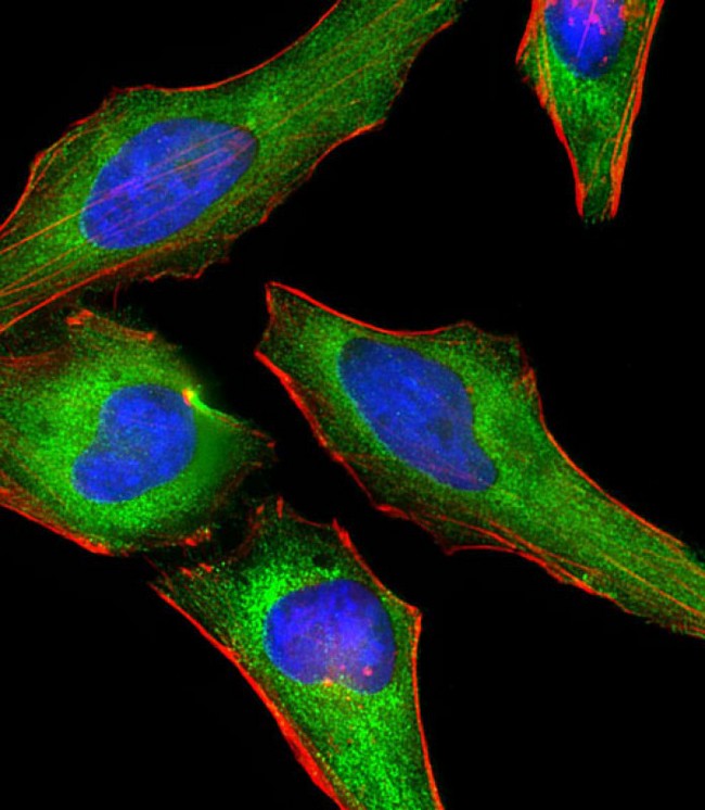 DNM2 / Dynamin-2 Antibody - Immunofluorescent analysis of 4% paraformaldehyde-fixed, 0.1% Triton X-100 permeabilized HeLa (human cervical epithelial adenocarcinoma cell line) cells labeling DNM2 with DNM2 Antibody (N-Term) at 1/25 dilution, followed by Dylight® 488-conjugated goat anti-rabbit IgG (NK179883) secondary antibody at 1/200 dilution (green). Immunofluorescence image showing cytoplasm staining on HeLa cell line. Cytoplasmic actin is detected with Dylight® 554 Phalloidin (PD18466410) at 1/100 dilution (red).The nuclear counter stain is DAPI (blue).