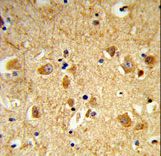 DNM3 / Dynamin 3 Antibody - Formalin-fixed and paraffin-embedded human brain tissue reacted with DNM3 Antibody , which was peroxidase-conjugated to the secondary antibody, followed by DAB staining. This data demonstrates the use of this antibody for immunohistochemistry; clinical relevance has not been evaluated.