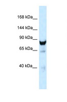 DNM3 / Dynamin 3 Antibody - DNM3 / Dynamin-3 antibody Western blot of Mouse Brain lysate. Antibody concentration 1 ug/ml.  This image was taken for the unconjugated form of this product. Other forms have not been tested.