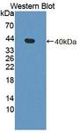 DNM3 / Dynamin 3 Antibody - Western Blot; Sample: Recombinant protein.