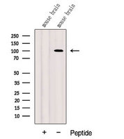 DNM3 / Dynamin 3 Antibody - Western blot analysis of extracts of mouse brain tissue using DNM3 antibody. The lane on the left was treated with blocking peptide.