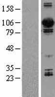 DNM3 / Dynamin 3 Protein - Western validation with an anti-DDK antibody * L: Control HEK293 lysate R: Over-expression lysate