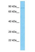 DNMBP / TUBA Antibody - DNMBP / TUBA antibody Western Blot of PANC1. Antibody dilution: 1 ug/ml.  This image was taken for the unconjugated form of this product. Other forms have not been tested.
