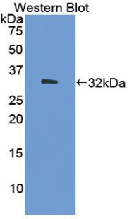 DNMT / DNMT1 Antibody - Western Blot; Sample: Recombinant protein.