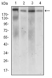 DNMT / DNMT1 Antibody - Western blot using IL2RA mouse monoclonal antibody against Jurkat (1), Cos7 (2), HCT116 (3) and NTERA-2 (4) cell lysate.