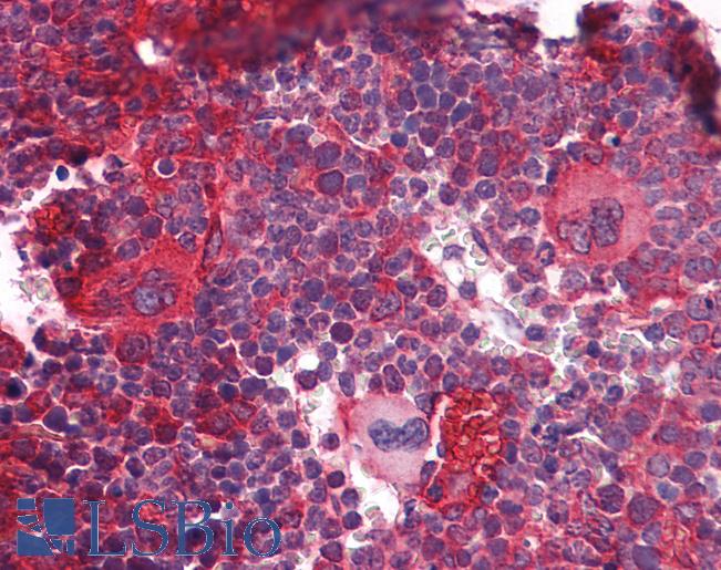 DNMT / DNMT1 Antibody - Anti-DNMT1 antibody IHC of mouse lymphoid tissue. Immunohistochemistry of formalin-fixed, paraffin-embedded tissue after heat-induced antigen retrieval. Antibody concentration 5 ug/ml.  This image was taken for the unconjugated form of this product. Other forms have not been tested.