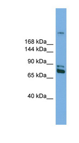 DNMT / DNMT1 Antibody - DNMT1 antibody Western blot of Mouse Lung lysate. This image was taken for the unconjugated form of this product. Other forms have not been tested.