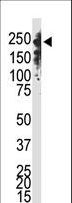 DNMT / DNMT1 Antibody - The anti-Dnmt1 C-term antibody is used in Western blot to detect Dnmt1 in Jurkat cell lysate.