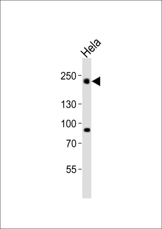 DNMT / DNMT1 Antibody - Western blot of lysate from HeLa cell line with DNMT1 Antibody. Antibody was diluted at 1:1000. A goat anti-rabbit IgG H&L (HRP) at 1:10000 dilution was used as the secondary antibody. Lysate at 20 ug.