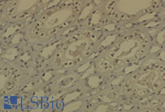 DNMT / DNMT1 Antibody - IHC analysis of DNMT1 in medullar kidney tissue sections using DNMT / DNMT1 antibody.  This image was taken for the unconjugated form of this product. Other forms have not been tested.