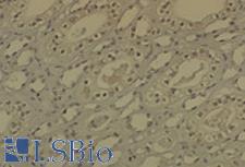 DNMT / DNMT1 Antibody - IHC analysis of DNMT1 in medullar kidney tissue sections using DNMT / DNMT1 antibody.  This image was taken for the unconjugated form of this product. Other forms have not been tested.