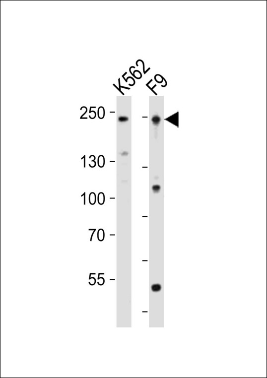 DNMT / DNMT1 Antibody - Western blot of lysates from K562, mouse F9 cell line (from left to right), using Dnmt1 antibody diluted at 1:1000 at each lane. A goat anti-rabbit IgG H&L (HRP) at 1:10000 dilution was used as the secondary antibody. Lysates at 20 ug per lane.