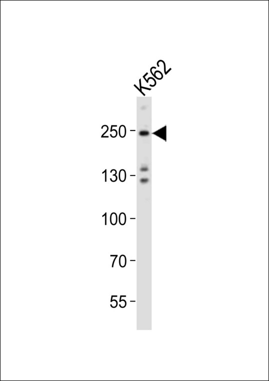 DNMT / DNMT1 Antibody - Western blot of lysate from K562 cell line, using Dnmt1 antibody diluted at 1:1000. A goat anti-rabbit IgG H&L (HRP) at 1:10000 dilution was used as the secondary antibody. Lysate at 20 ug.