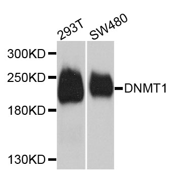 DNMT / DNMT1 Antibody - Western blot analysis of extracts of various cells.