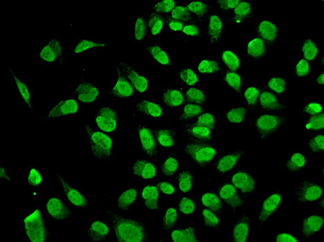 DNMT / DNMT1 Antibody - Immunofluorescence analysis of A549 cells.