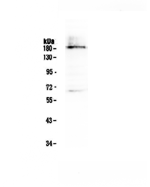 DNMT / DNMT1 Antibody - Western blot - Anti-Dnmt1 Picoband antibody