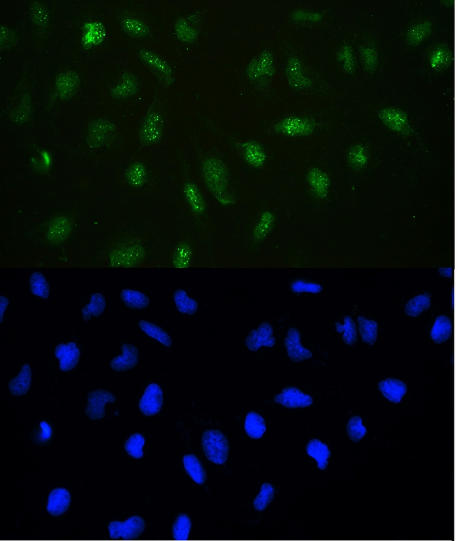 DNMT / DNMT1 Antibody - IF analysis of Dnmt1 using anti-Dnmt1 antibody Dnmt1 was detected in immunocytochemical section of U20S cell. Enzyme antigen retrieval was performed using IHC enzyme antigen retrieval reagent for 15 mins. The tissue section was blocked with 10% goat serum. The tissue section was then incubated with 2µg/mL rabbit anti-Dnmt1 Antibody overnight at 4°C. DyLight®488 Conjugated Goat Anti-Rabbit IgG was used as secondary antibody at 1:100 dilution and incubated for 30 minutes at 37°C. The section was counterstained with DAPI. Visualize using a fluorescence microscope and filter sets appropriate for the label used.